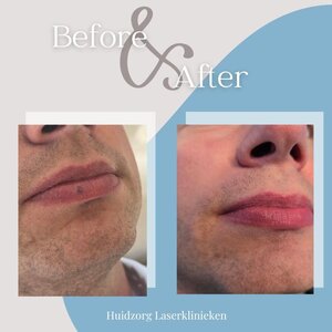 Huidzorg Laserklinieken image 1