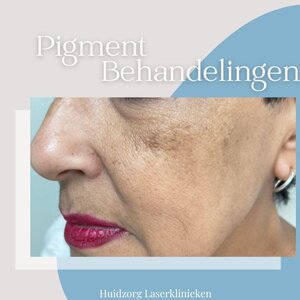 Huidzorg Laserklinieken image 5