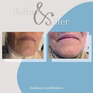 Huidzorg Laserklinieken image 6