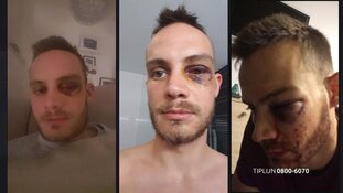 Gezocht: Ernstige mishandeling tijdens festival in Eindhoven